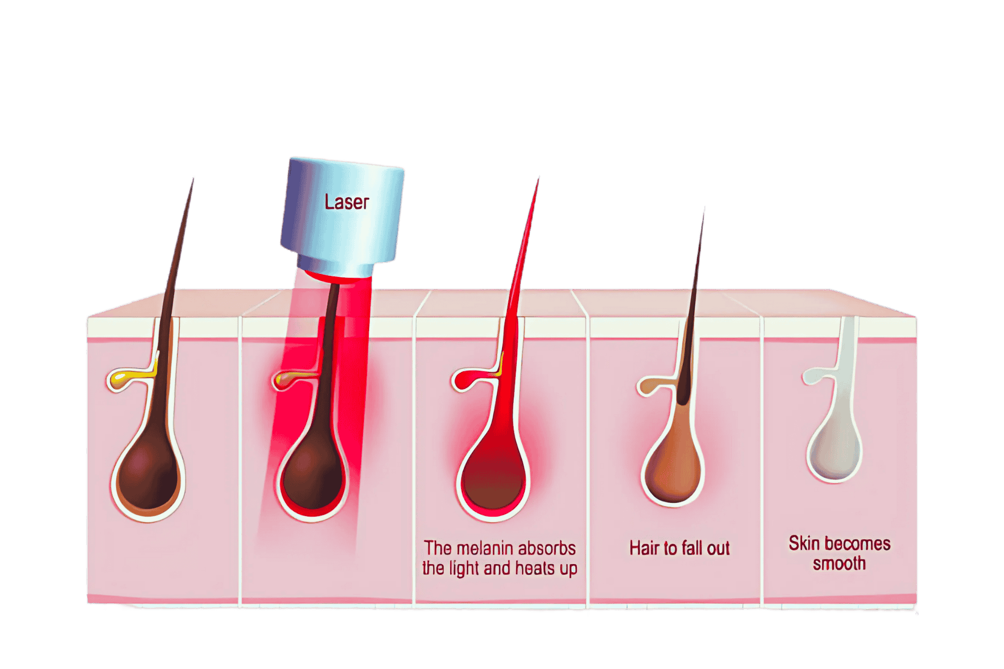 Step-by-Step Process